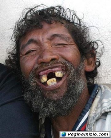 Un sorriso a 32 denti!