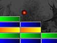 Gioco Artanoid