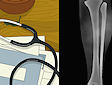 <b>Operazione alle gambe - Leg surgery